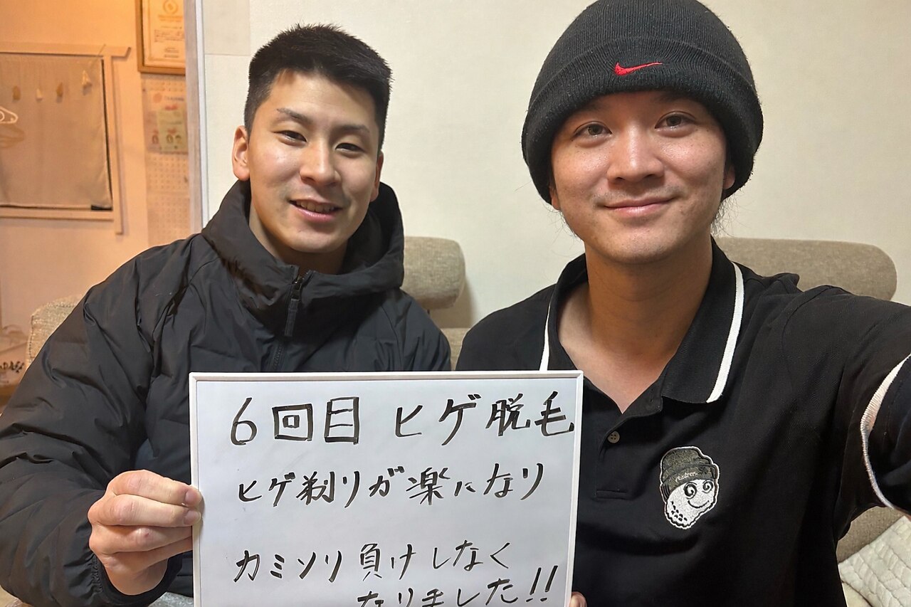ヒゲ脱毛 6回目の施術イメージ